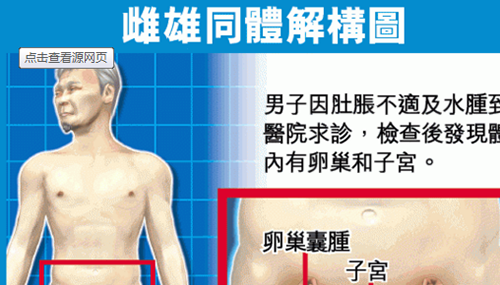 雌雄难辨的两性人，拥有两套生殖器官525 / 作者:网上的人生 / 帖子ID:48841