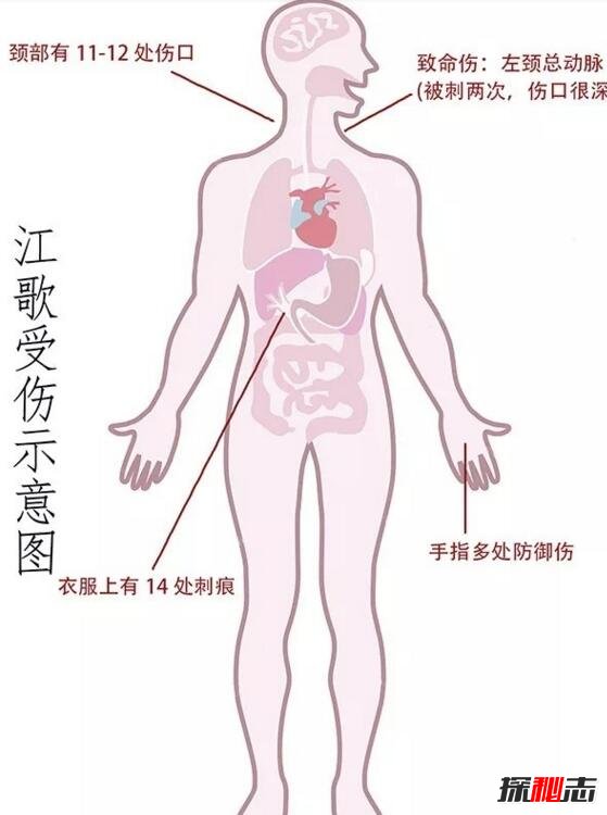 陈世峰下跪向江母磕头，检方称顶多被判20年412 / 作者:网上的人生 / 帖子ID:49581