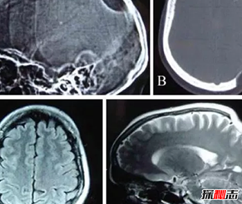 人骨为什么那么可怕-人体骨骼的十大疯狂事实55 / 作者:网上的人生 / 帖子ID:52913