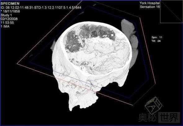 英格兰发现2500年前保存完好的大脑201 / 作者:UFO外星人爱好者 / 帖子ID:60127