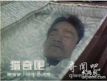 李小龙怎么死的 李小龙死亡验尸照片曝光811 / 作者:UFO外星人爱好者 / 帖子ID:58811