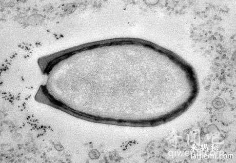 尼安德特人病毒：某些癌症患者发现匹配DNA223 / 作者:UFO来啦 / 帖子ID:63602