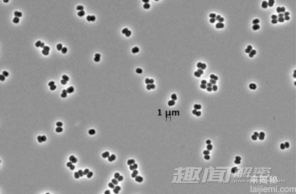 揭秘：2014年自然界新发现十大物种排行282 / 作者:UFO来啦 / 帖子ID:64021