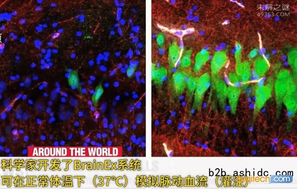 美国科学家成功复活了猪的大脑，死亡的大脑有复活的可能585 / 作者:UFO爱好者 / 帖子ID:70506