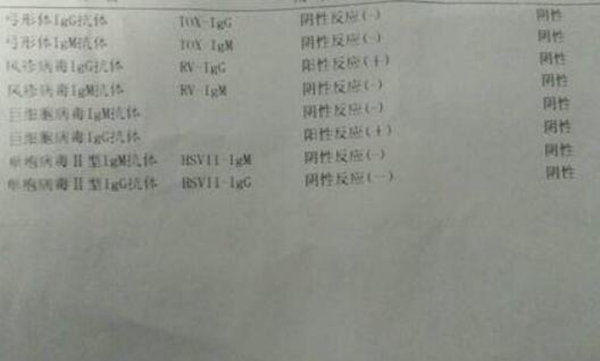 精元抗体是什么意思?GPAL化验单了解女性几个前任?725 / 作者:UFO爱好者 / 帖子ID:104081