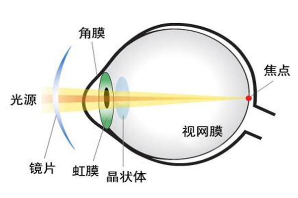 散光是怎么造成的 人为什么会发生散光337 / 作者:UFO爱好者 / 帖子ID:88981