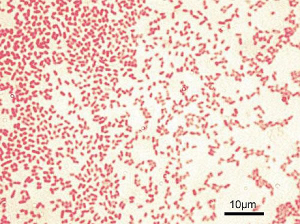 人类语言起源进化研究新视角 或起源自鸟类、猿猴语言963 / 作者:UFO爱好者 / 帖子ID:85486