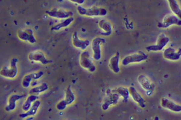 食脑虫会吃人脑吗 诱发脑膜炎潜伏期短(99%死亡率)463 / 作者:UFO爱好者 / 帖子ID:80388