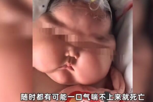 5个月大的女婴抹了婴儿霜后变“大头娃娃”，月胖3斤563 / 作者:UFO爱好者 / 帖子ID:76137